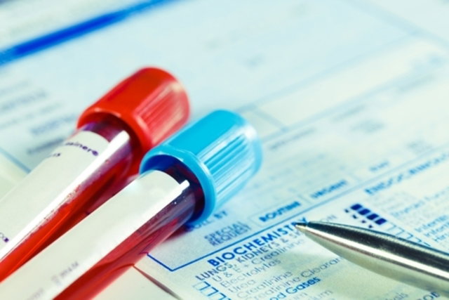 Exame de sangue para medir níveis de ACTH